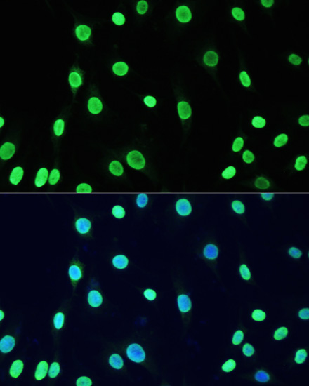 Acetyl-DNMT1-K1127/K1129/K1131/K1133 Rabbit pAb