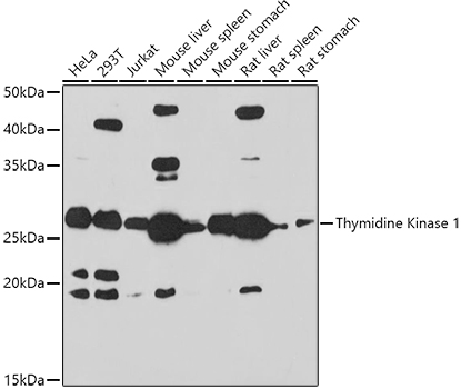 Thymidine Kinase 1 Rabbit pAb