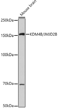 KDM4B/JMJD2B Rabbit pAb