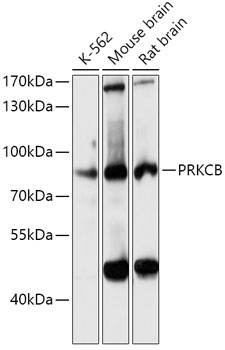 PKC-beta Rabbit pAb