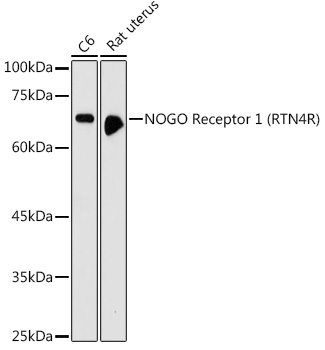 NOGO Receptor 1 (RTN4R) Rabbit pAb