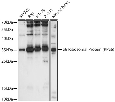 S6 Ribosomal Protein (RPS6) Rabbit pAb