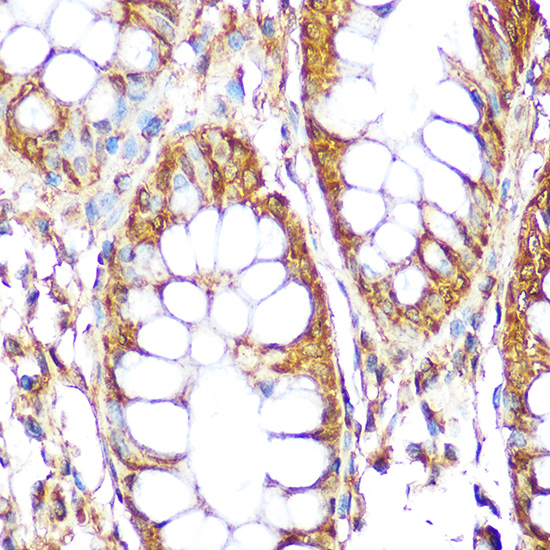 S6 Ribosomal Protein (RPS6) Rabbit pAb