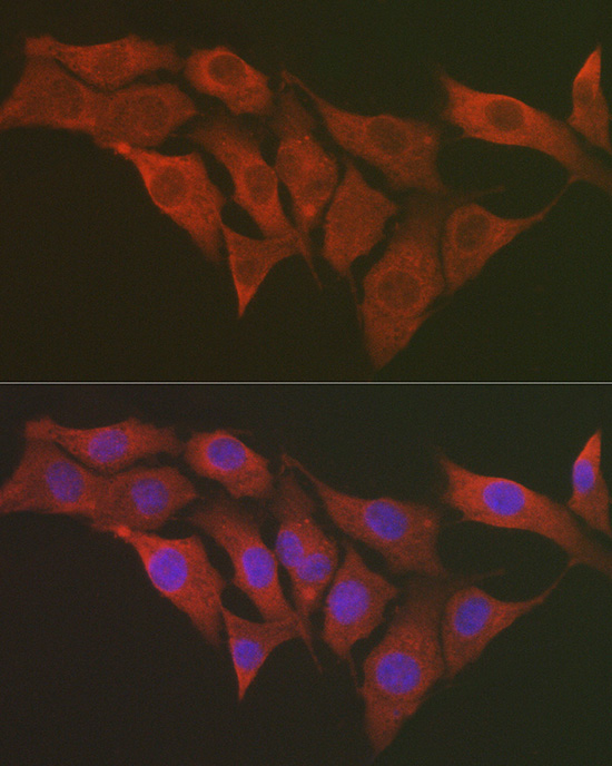 S6 Ribosomal Protein (RPS6) Rabbit pAb