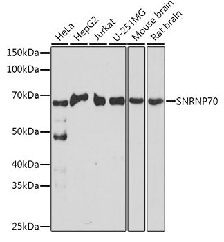 SNRNP70 Rabbit pAb