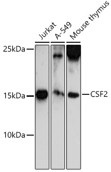 CSF2 Rabbit pAb