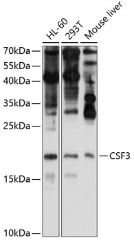 CSF3 Rabbit pAb