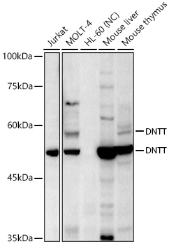 TdT Rabbit pAb