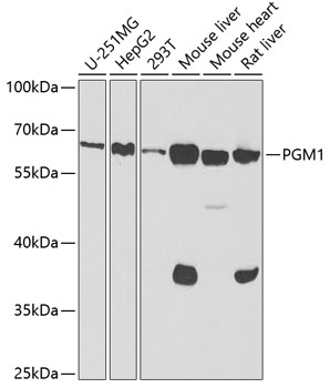 PGM1 Rabbit pAb