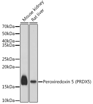 Peroxiredoxin 5 (PRDX5) Rabbit pAb