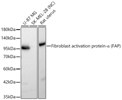 Fibroblast activation protein-α (FAP) Rabbit pAb