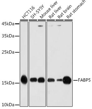 FABP5 Rabbit pAb