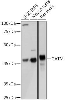 GATM Rabbit pAb