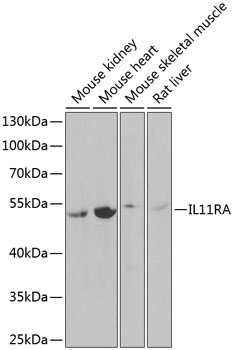 ma5ページ IL11RA Rabbit mAb