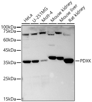 PDXK Rabbit pAb