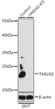 [KO Validated] TAGLN2 Rabbit pAb