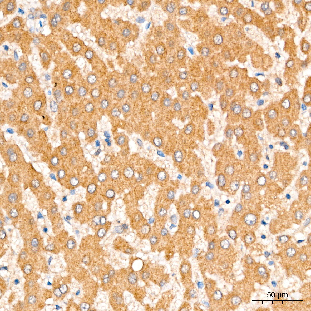 ACSL4 Rabbit pAb-Polyclonal Antibodies - ABclonal/拜爾國際(BioAb)