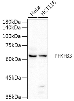 PFKFB3 Rabbit pAb