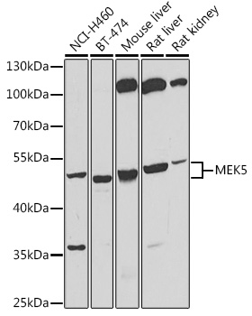 MEK5 Rabbit pAb