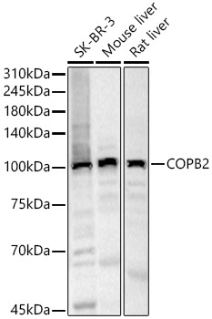 COPB2 Rabbit pAb