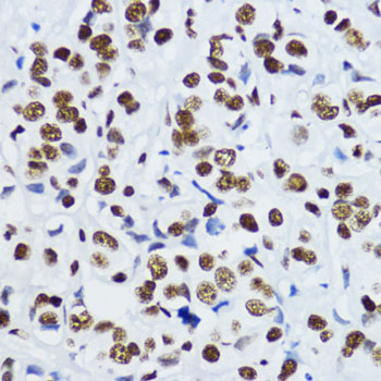 Acetyl-Histone H3-K9 Rabbit pAb