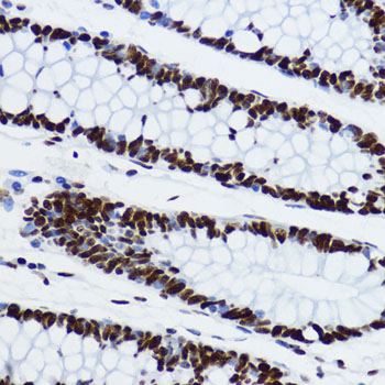 Acetyl-Histone H3-K9 Rabbit pAb