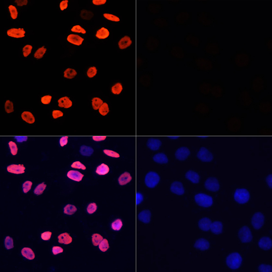 Acetyl-Histone H3-K9 Rabbit pAb