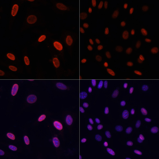 Acetyl-Histone H3-K9 Rabbit pAb