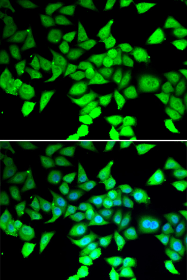 HDAC7 Rabbit pAb