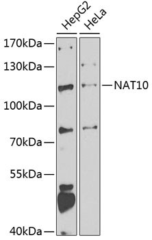 NAT10 Rabbit pAb