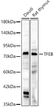 [KD Validated] TFEB Rabbit pAb