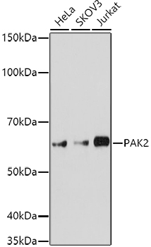 PAK2 Rabbit pAb