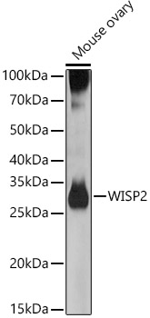 WISP2 Rabbit pAb WISP2 Rabbit pAb