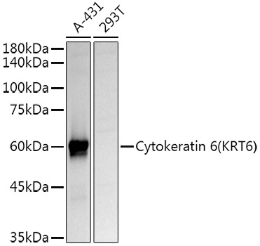 Cytokeratin 6 (KRT6) Rabbit pAb