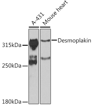 Desmoplakin Rabbit pAb