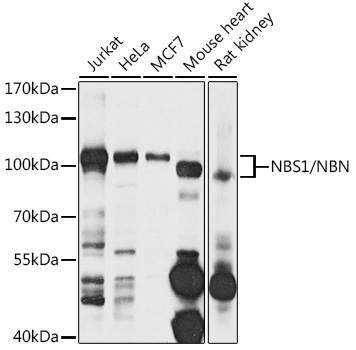 NBS1/NBN Rabbit pAb