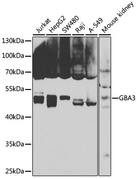 GBA3 Rabbit pAb-Polyclonal Antibodies - ABclonal/拜爾國際(BioAb)