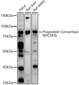 Proprotein Convertase 9(PCSK9) Rabbit pAb