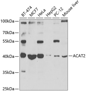 ACAT2 Rabbit pAb