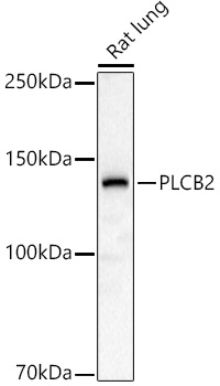 PLCB2 Rabbit pAb