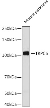 TRPC6 Rabbit pAb