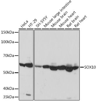 SOX10 Rabbit mAb