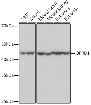 OPRD1 Rabbit mAb