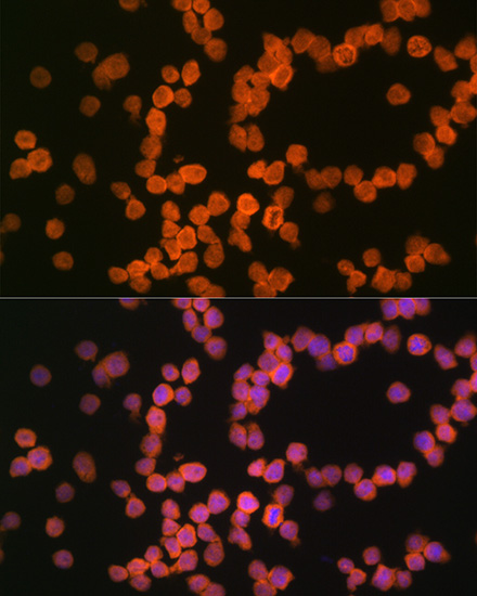 MHC class I (HLA-A/B) Rabbit mAb