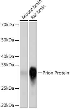 Prion Protein Rabbit mAb