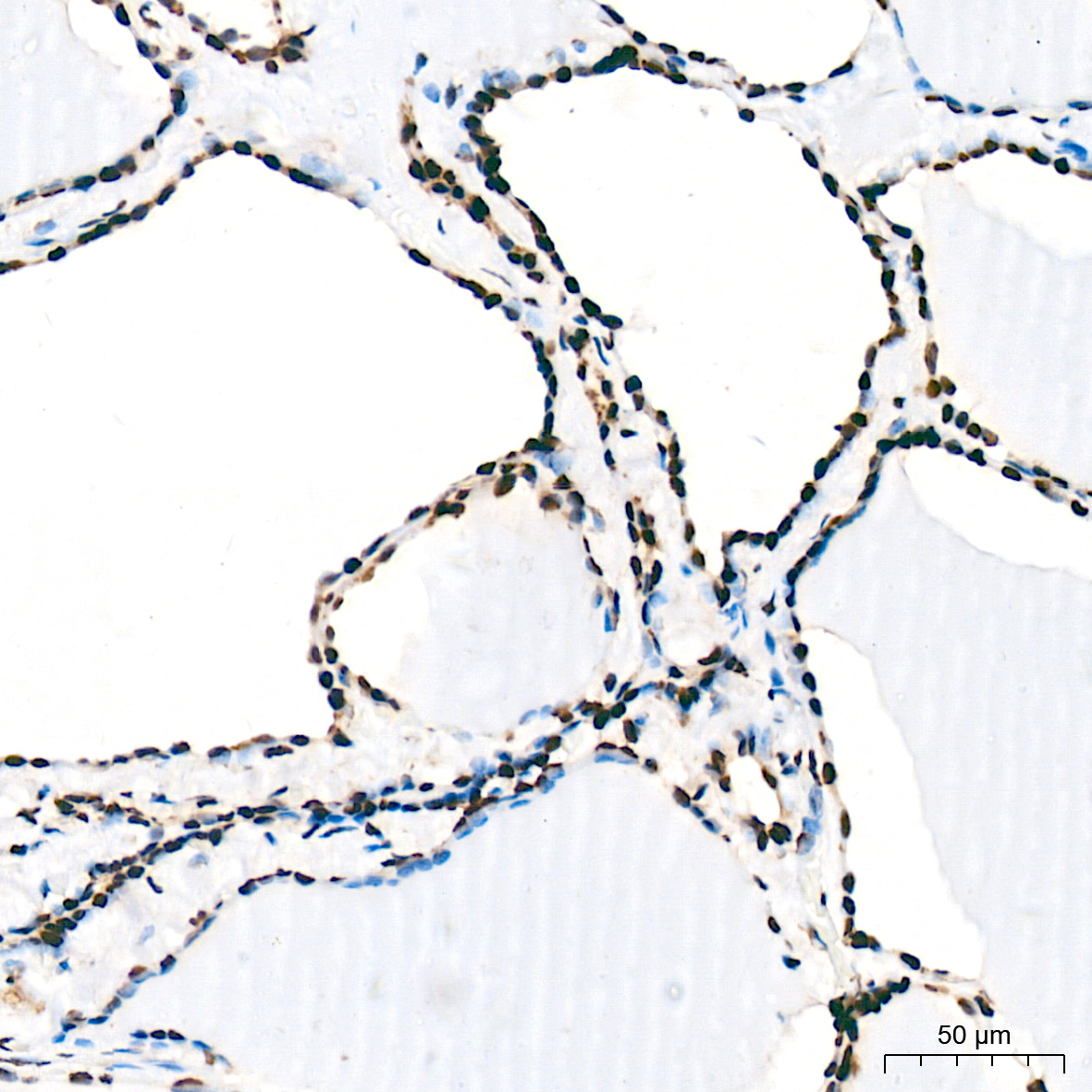 FUBP1 Rabbit mAb