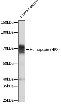 Hemopexin (HPX) Rabbit mAb