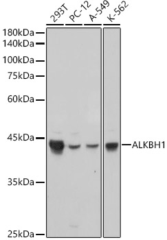 ALKBH1 Rabbit mAb