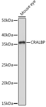 CRALBP Rabbit mAb