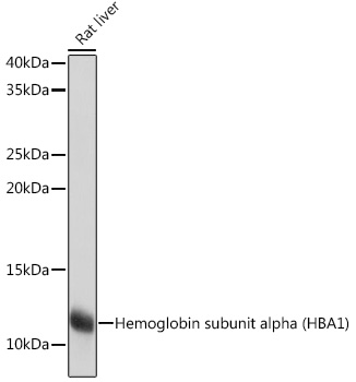 Hemoglobin subunit alpha (HBA1) Rabbit mAb